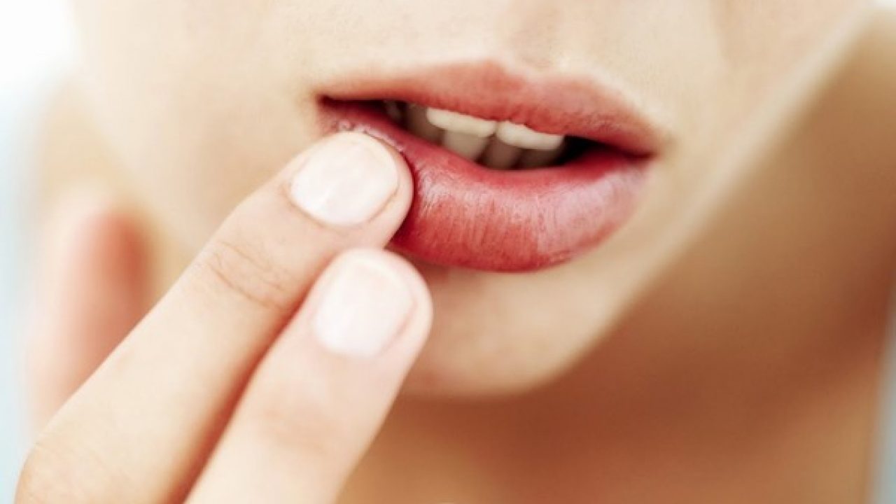 Nguyên nhân và cách điều trị xăm môi bị lở loét